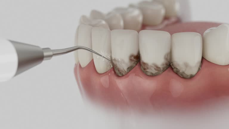 Reliable Dental Implants contractor in Oasis, CA by Smile Center Dentistry